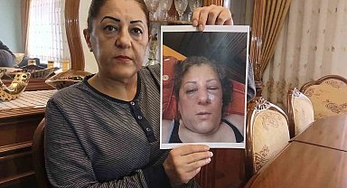 Apartman bahçesinde beslediği kediler nedeniyle komşuları tarafından darbedilen kadının burnu kırıldı