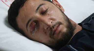 Düğün eğlencesi kabusa döndü: Sağ gözünden oldu